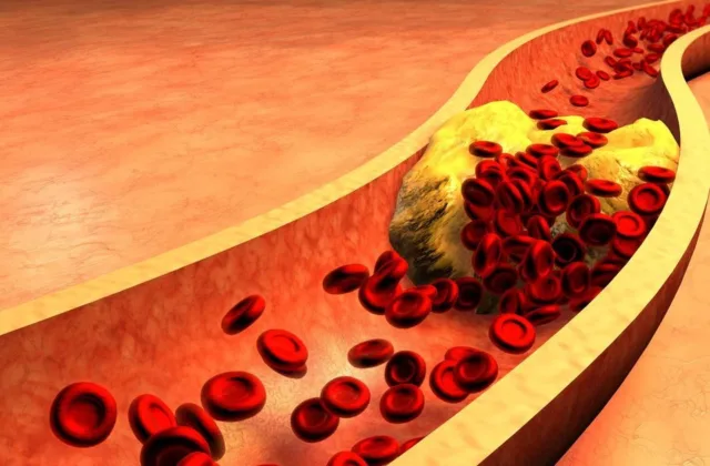 Mažas kopūstas, didelis poveikis: kuo jis gali padėti cholesterolio kiekiui ir kraujagyslėms