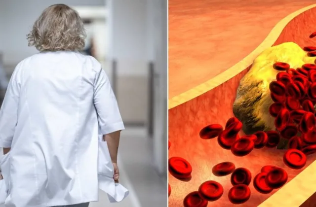 Cholesterolis nebesirenka tik vyresnių: gydytojus sunerimti verčia tai, kas prasideda jau nuo 30-ies