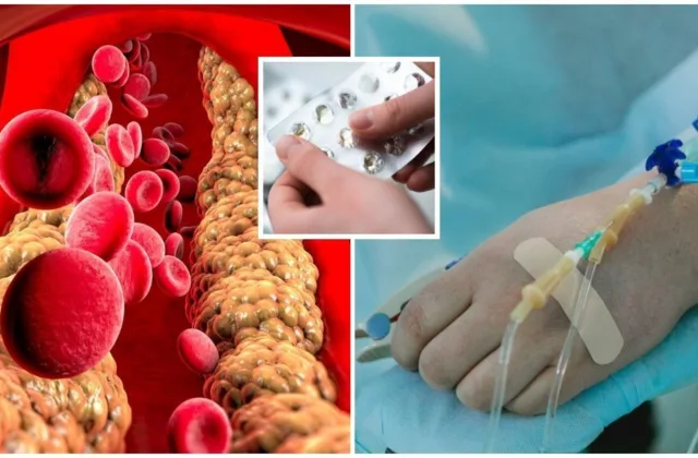 Statinų baimė slepia svarbią tiesą: kam šie vaistai iš tiesų būtini, o kada cholesterolį galima mažinti kitaip